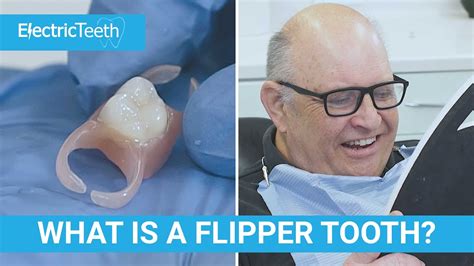 On the other hand, partial dentures are made for three or more teeth, whether or not they’re in a row. . How to put in a flipper tooth